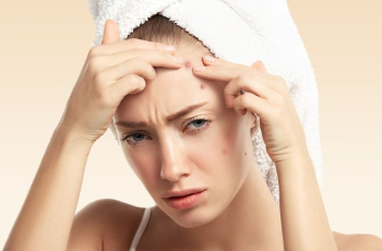 From eczema to hyperpigmentation, 5 common monsoon skin concerns and how to deal with them