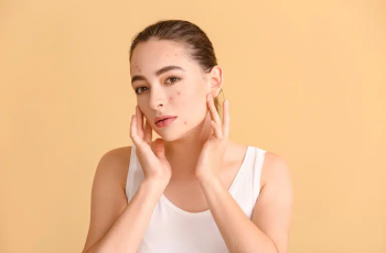 Understanding the Impact of Stress on Skin and Effective Treatment Options Understanding the Impact of Stress on Skin and Effective Treatment Options