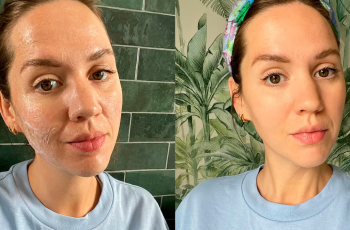 Slugging Trend: Is It Worth Trying for Your Skin Type?