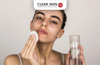 Clearer Skin Ahead: Skincare Solutions for Acne Scarring