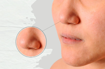 Dealing with Dry Skin: Why Patches Appear and How to Fix Them Dealing with Dry Skin: Why Patches Appear and How to Fix Them