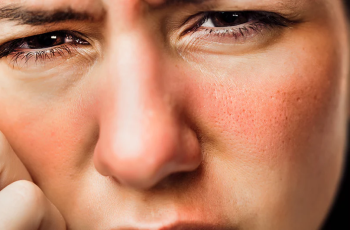 Skincare and Sun Sensitivity: Causes, Reactions, and Protection Tips Skincare and Sun Sensitivity: Causes, Reactions, and Protection Tips