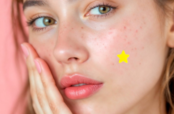 How Azelaic Acid Helps Reduce Rosacea and Redness How Azelaic Acid Helps Reduce Rosacea and Redness