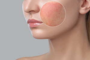 Skin Allergies and Skincare: Causes, Symptoms, and Treatment Guide