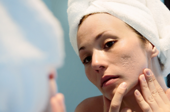 Scar Revision: Effective Treatments to Improve Skin’s Appearance
