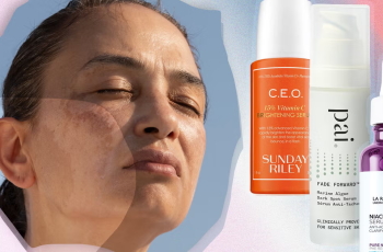 Essential Skin Care Tips to Fade and Manage Dark Spots