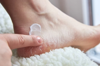 The Skincare Secret That Transformed My Dry, Cracked Feet