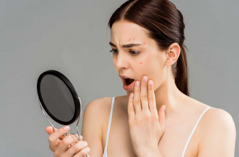 The Truth About Clearing Acne: How Long Until You See Results?