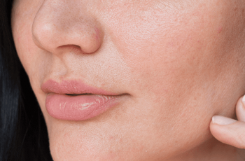 How Pollution Damages Your Skin and How to Stop It