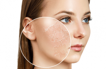 How to Tell If Your Skin’s Dehydrated—and What to Do About It