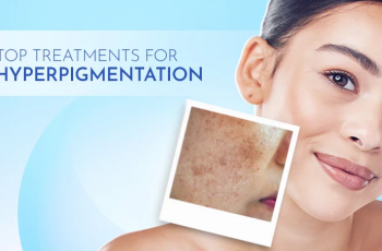 The Ultimate Guide to Treating PIH for All Skin Types