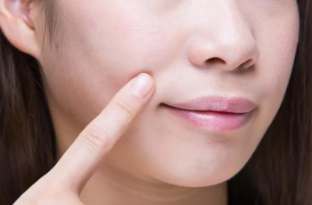 Expert Skincare Tips to Reduce Deep Wrinkles Around the Mouth