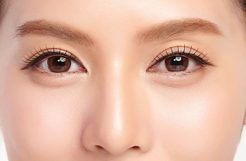 Say Goodbye to Under-Eye Bags: Causes, Prevention, and Treatments