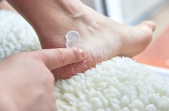 Expert Skincare Guide to Treat and Prevent Rough, Dry Feet