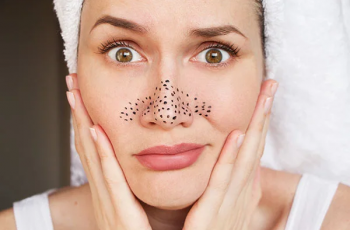 Effective Skincare Tips to Remove and Prevent Nose Blackheads