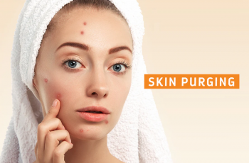 Lactic Acid and Skin Purging: Signs, Timeline, and What to Expect