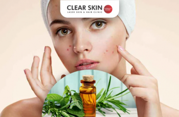 Tea Tree Oil for Back Acne: Natural Skincare That Works?